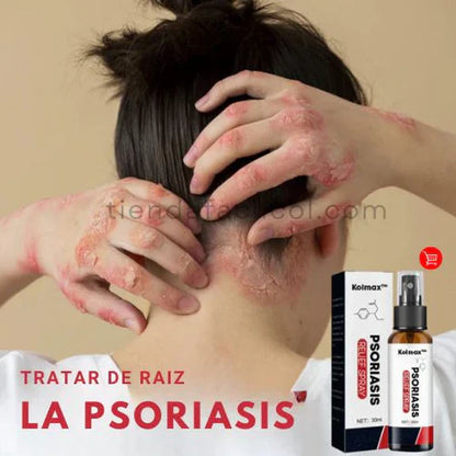 Psoriasis Treatment Sptray